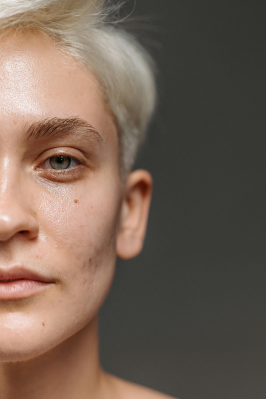 Visage d’une femme montrant un grain de peau irrégulier avec pores apparents 