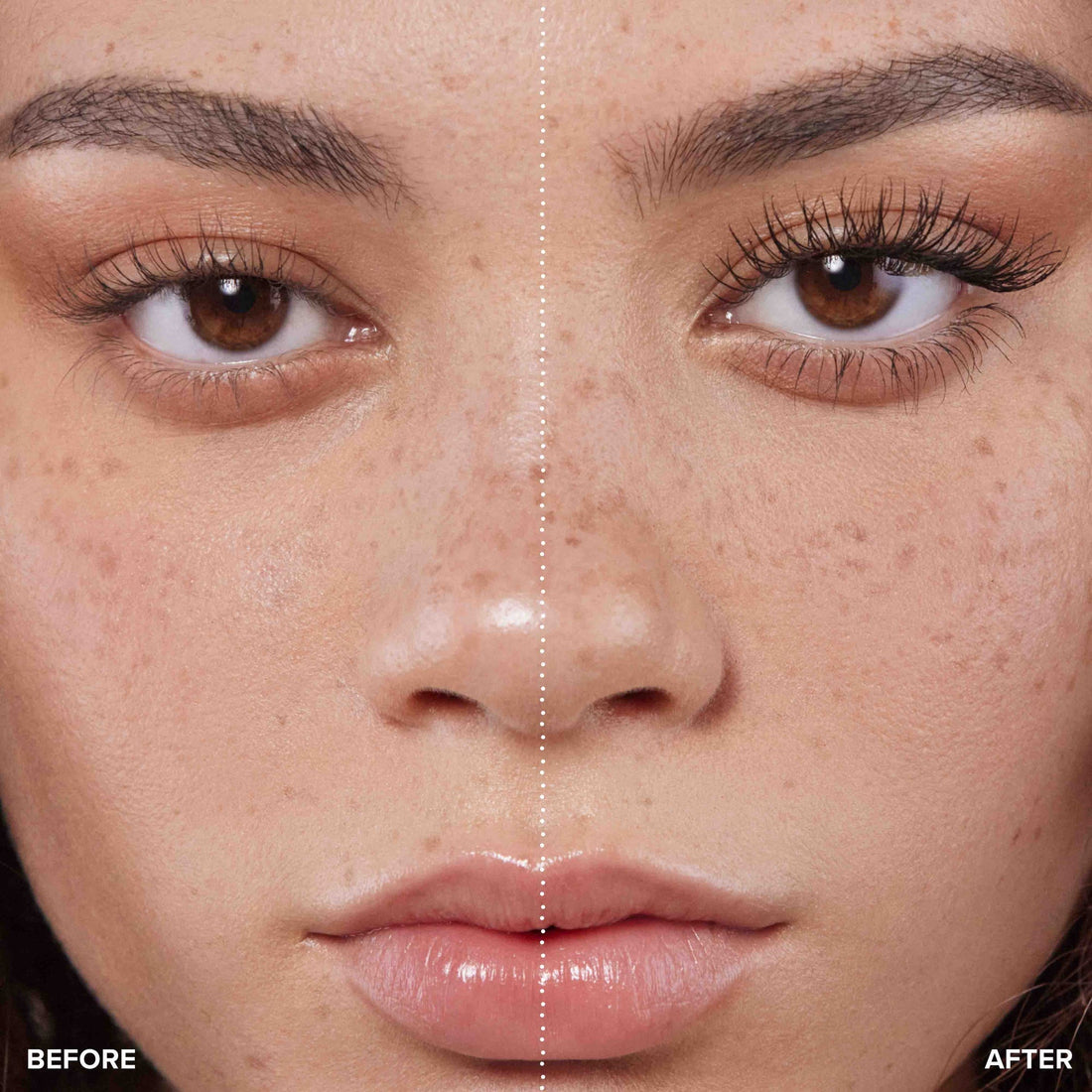 Pourquoi j’ai des boutons sur le visage ? (causes + solutions efficaces)