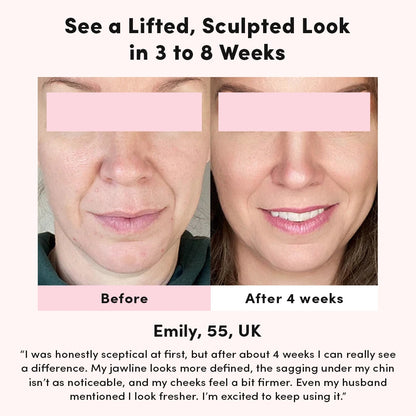 LiftContour Pro YRENNA